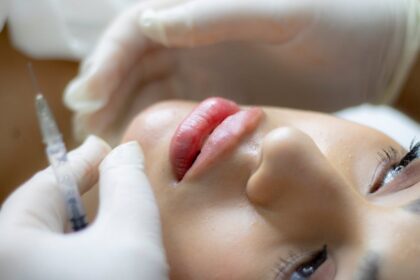 De 5 meest gestelde vragen over fillers beantwoord